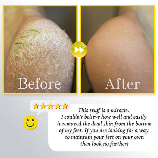 Uppladdningsbar elektrisk fotskrubber