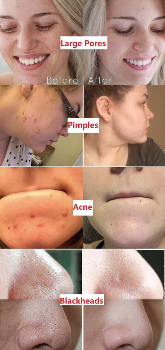 Varm försäljning -Djuprengörande mask med grönt te