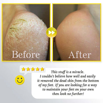 Uppladdningsbar elektrisk fotskrubber