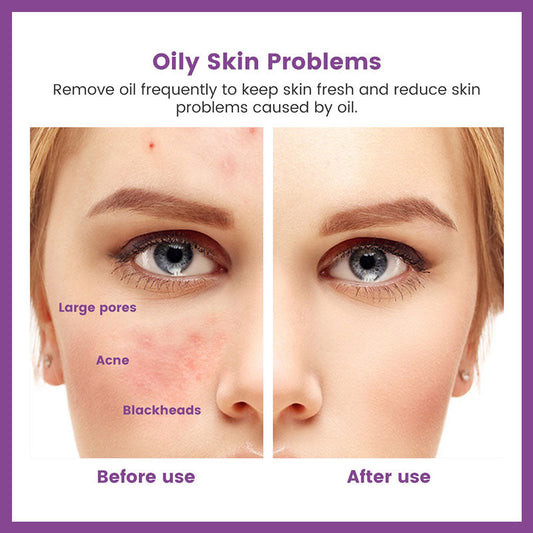 Bärbar vulkanisk sten oljeabsorberande rulle