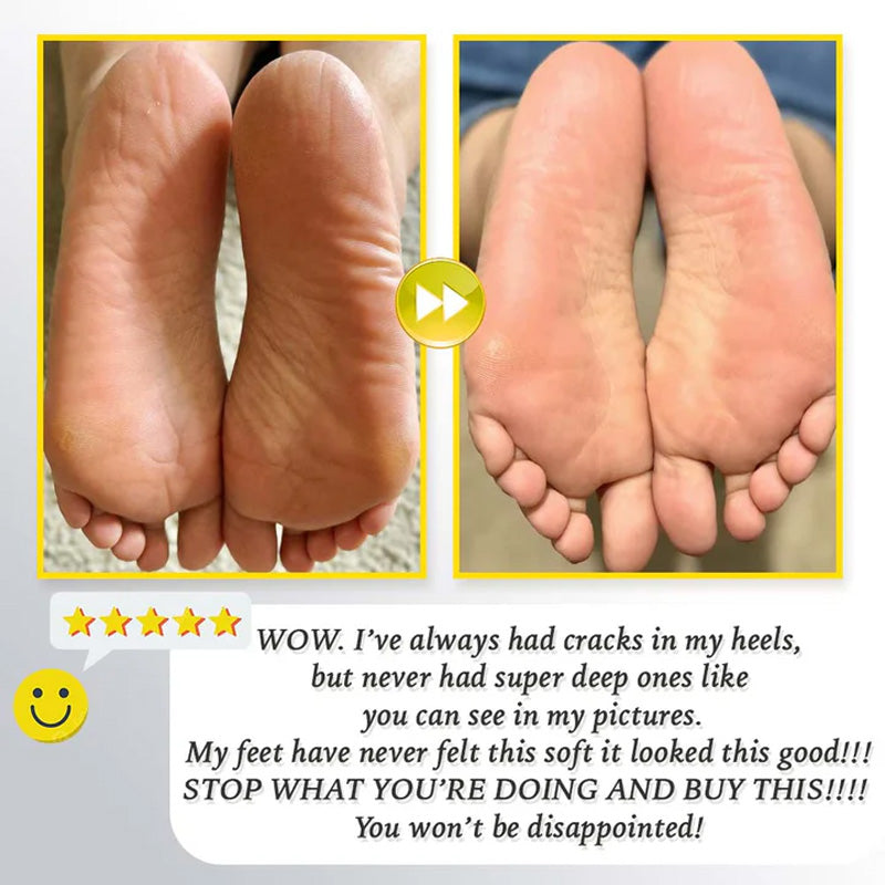 Uppladdningsbar elektrisk fotskrubber