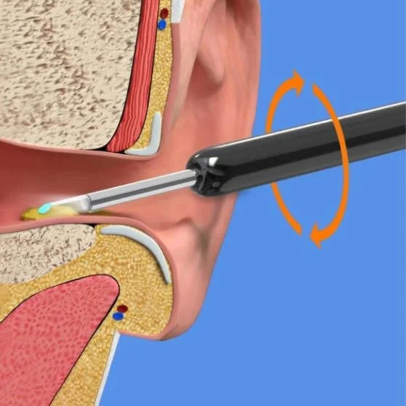 WiFi-version Visual Ear Pick