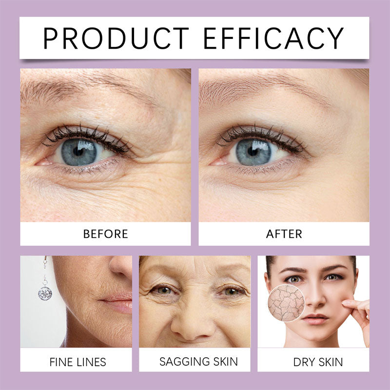 🎁2025 Nytt kollagen Retinol föryngringsserum