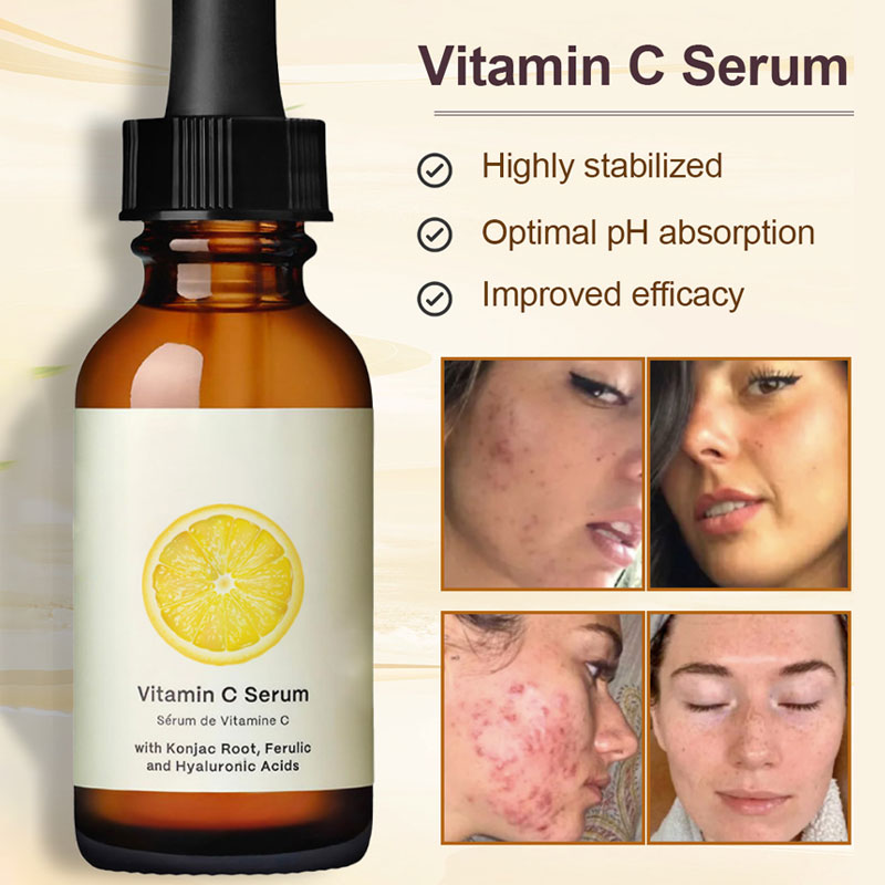 Citron C-vitamin Ljusgörande Återfuktande Essence🍋