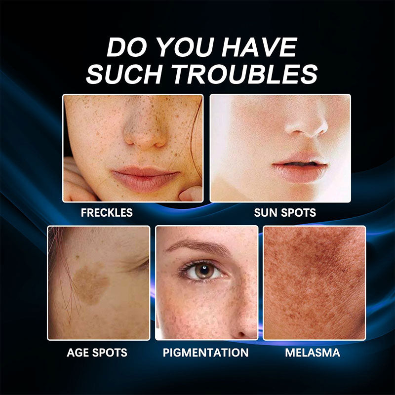 Förebyggande fuktkräm mot fräknar