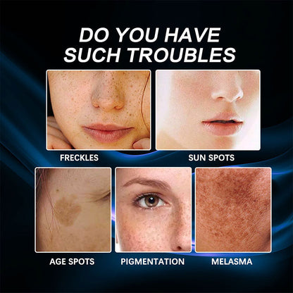 Förebyggande fuktkräm mot fräknar