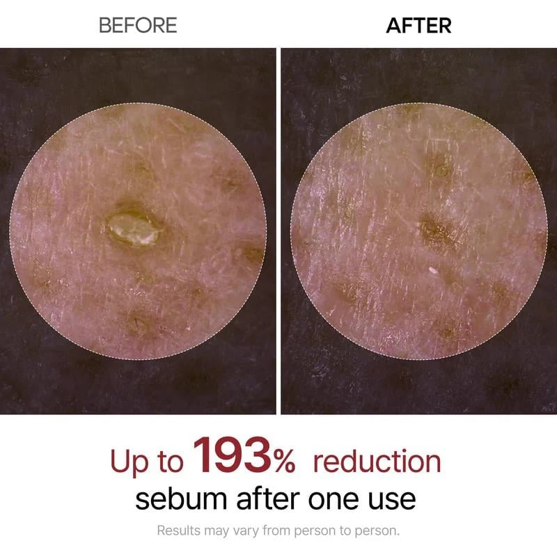 🏆Snabba rea⚡ Över 50 000 sålda! Nästan slut! 💥🔥 Peel Shot Glow Risampull Du