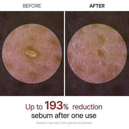 🏆Snabba rea⚡ Över 50 000 sålda! Nästan slut! 💥🔥 Peel Shot Glow Risampull Du